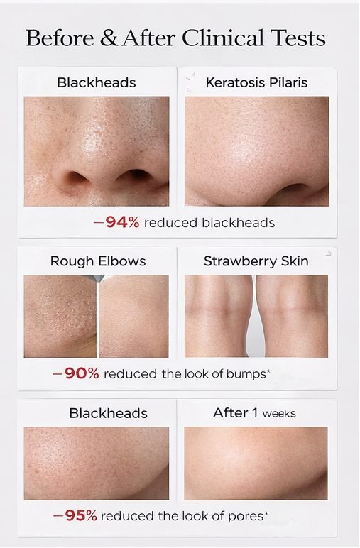 Lumera Pure Complete Skin Set